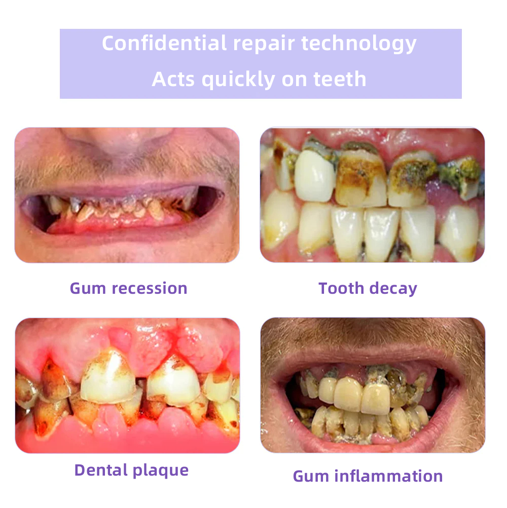 Oyikey® 🎁 Polvo Mineral para Restauración Dental (Blanqueamiento, Restauración de la Salud Dental)