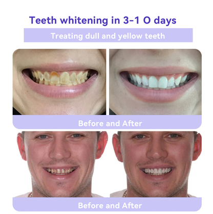 Oyikey® 🎁 Polvo Mineral para Restauración Dental (Blanqueamiento, Restauración de la Salud Dental)
