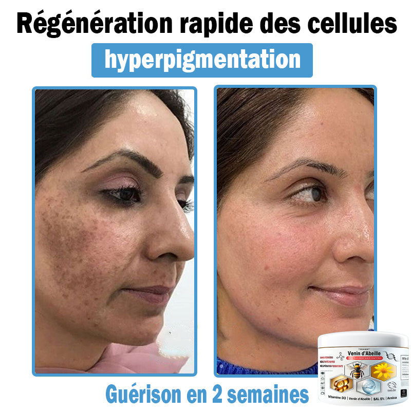 2 Pots⭐️Soulagement Instantané