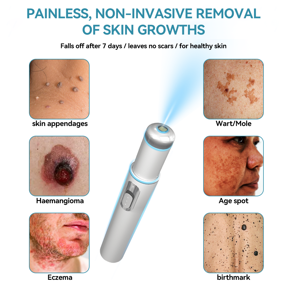 𝐉𝐚𝐬𝐬𝐞𝐞𝐦® Medical-Grade Laser Pen 🎉 (Powered by CO₂ laser technology – effectively removes moles, warts, skin tags, pigmentation spots, and other skin imperfections)