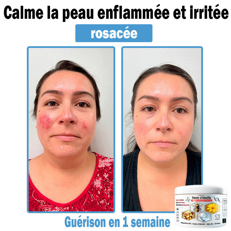 4 Pots🔥Guérison Complète