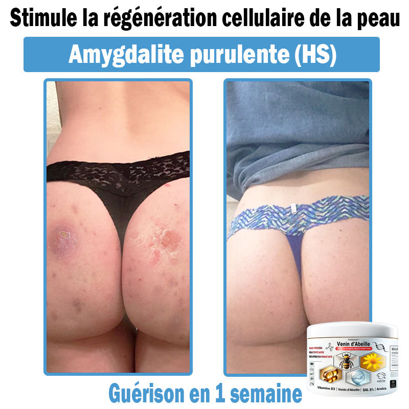 🎁1 Pot🎁 - Essayez-le