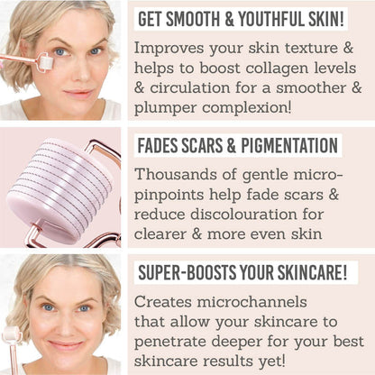 Rose on Rose Derma Roller