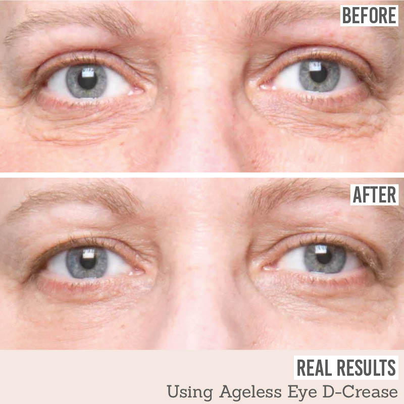 Ageless Eye D-Crease