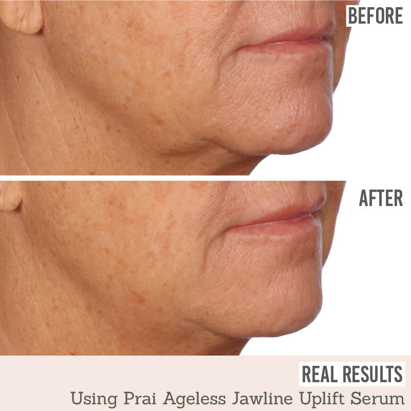 Ageless Jawline Uplift Serum