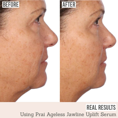 Ageless Jawline Uplift Serum