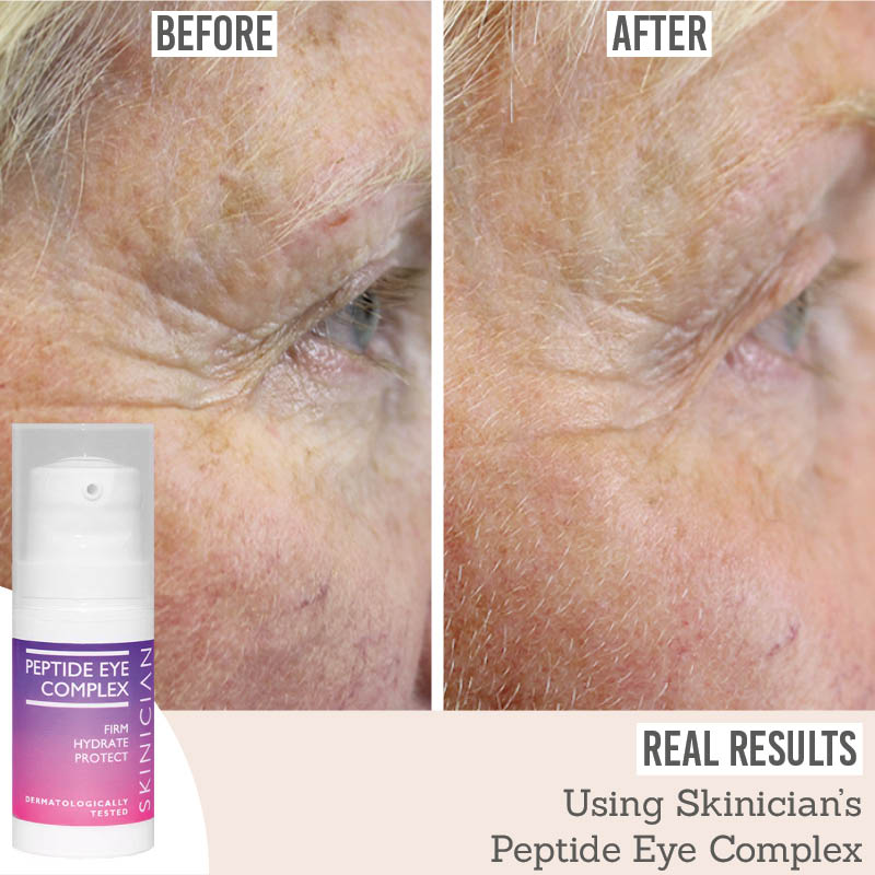 Ageless Peptide Eye Complex