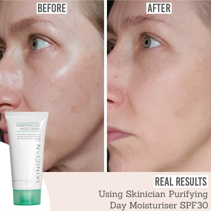 Purifying Day Moisturiser SPF 30