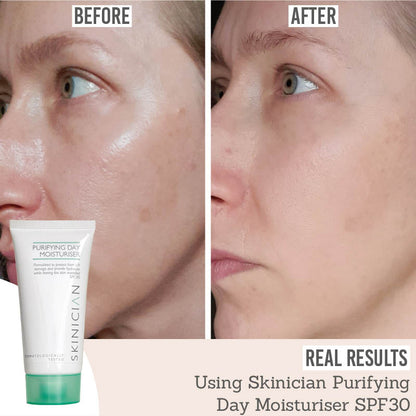 Purifying Day Moisturiser SPF 30